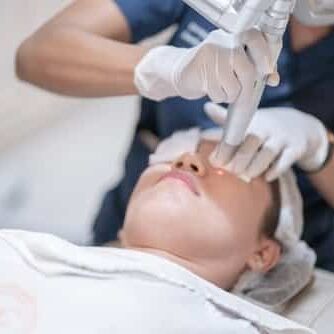 Dermatologist,Is,Doing,Laser,Treatment,On,Asian,Girl's,Face,To